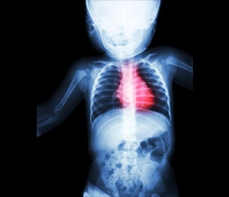 X-ray image