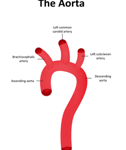 Normal Aorta